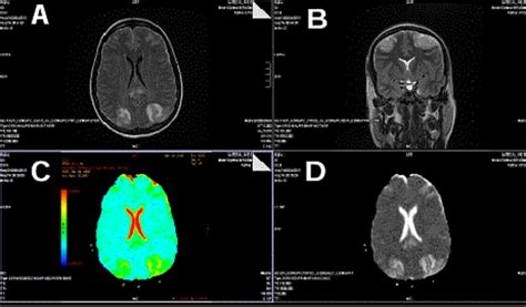 CT scan axial images. | Download Scientific Diagram