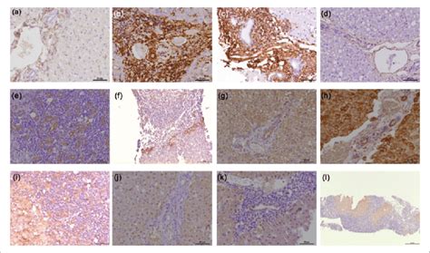 Immunolocalisation of the expression of hepatic progenitor cell markers ...