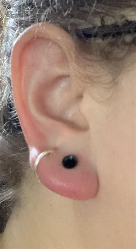 Swollen earlobe. I am gauging my first lobe and I got it up to a 6g about 5 days ago and pierced ...