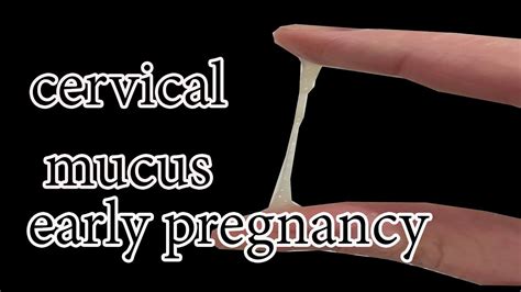 cervical mucus in early pregnancy - YouTube