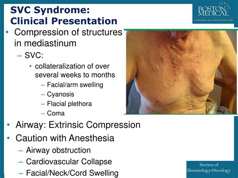 PPT - HEMATOLOGY-ONCOLOGY PowerPoint Presentation, free download - ID:2983190