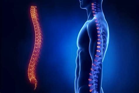 Spondylosis in thoracic spine: Spondylosis Signs and Symptoms I Spondylosis Treatment