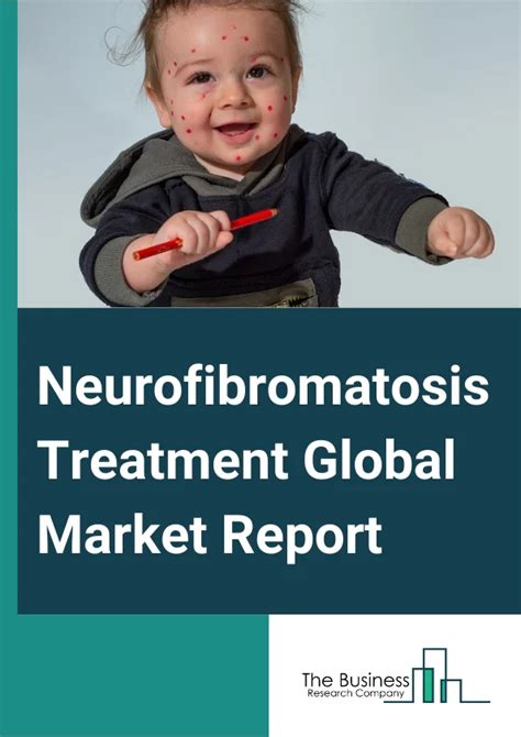 Neurofibromatosis Treatment Market Report 2024 - Neurofibromatosis Treatment Size And Growth ...