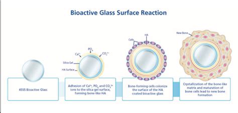 What is Bioactive Glass? - Medivizor