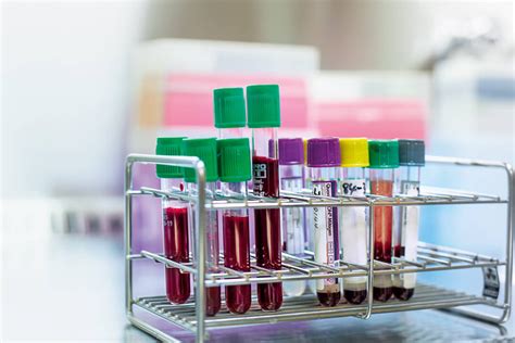 Role of Blood Collection Tube Additives in a Pathology Lab - Biomall Blog