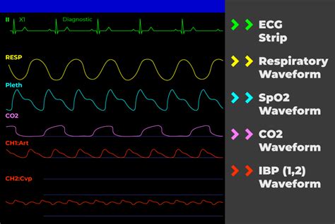 How to Read a Patient Monitor: Numbers and Lines Explained