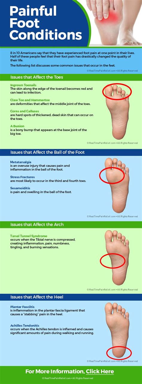 Here is a list of painful foot conditions that may be affecting you ...