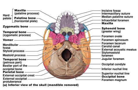 Temporal Bone Carotid Canal