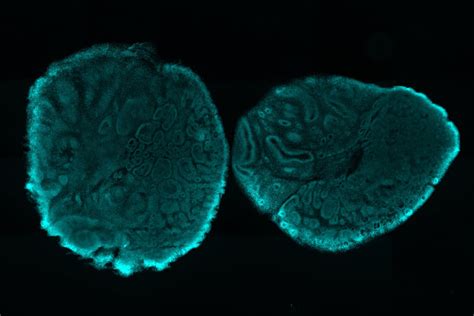 Imaging Organoid Models to Investigate Brain Health | Science Lab ...