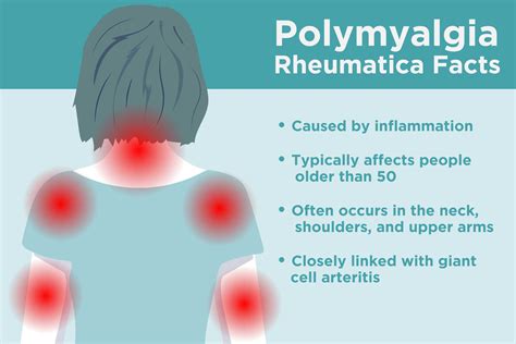 Polymyalgia Rheumatica - Symptoms, Causes, Risk Factors & Complications