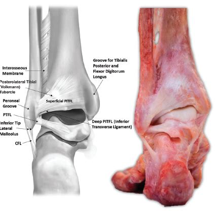 Anatomy 101: Ankle Syndesmosis - Distal Tibiofibular Joint — Rayner & Smale