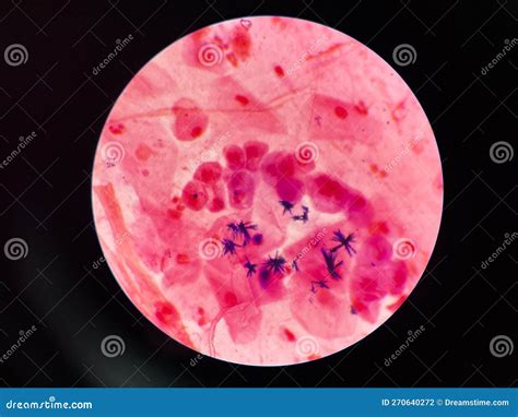 Bacteria Cell in Sputum Sample Gram Stain Method Stock Photo - Image of ...