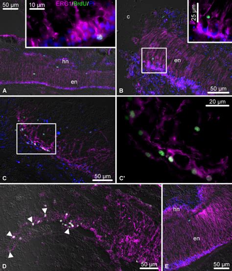 Representative micrographs showing distribution of BrdU-incorporating ...