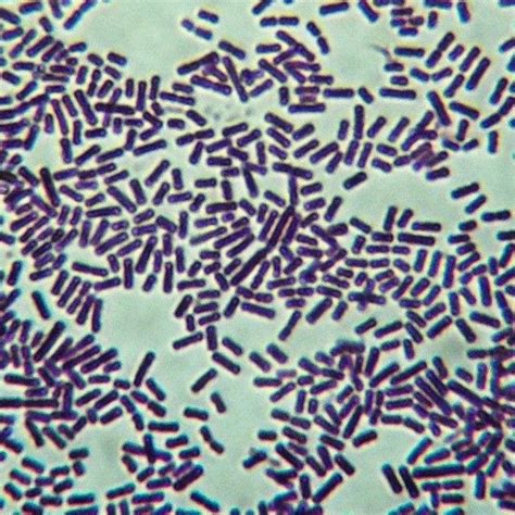 Clostridium perfringens | Medical laboratory science, Medical ...