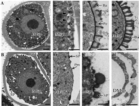 Ultrastructure of the pollen wall development in wild-type (A, C, E,... | Download Scientific ...