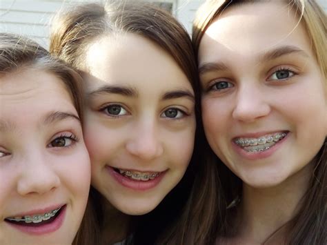 Young Girls With Braces On Teeth – Telegraph