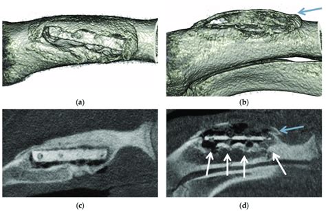 Micro-CT images recorded 6 months after surgery: (a) 3D reconstruction... | Download Scientific ...