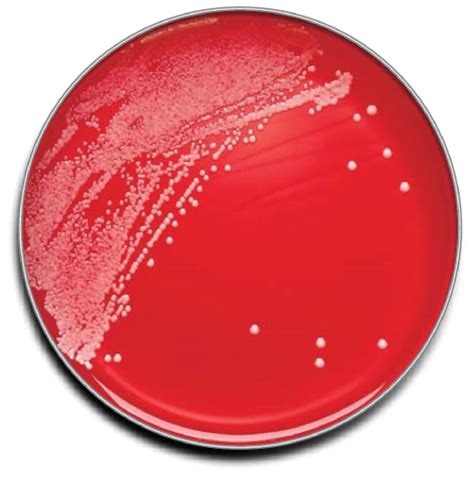 BD BBL Brain Heart Infusion Agar w/10% Sheep Blood, Gentamicin ...