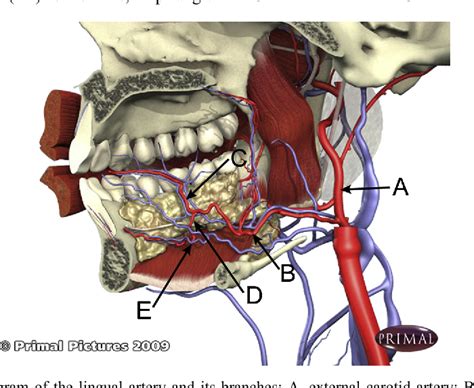 Figure 1 from A new method for displaying the lingual artery using high-resolution three ...