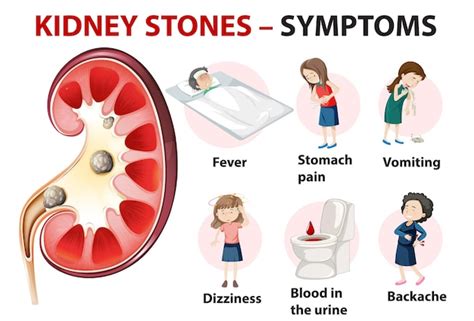 Free Vector | Kidney stones symptoms cartoon style infographic