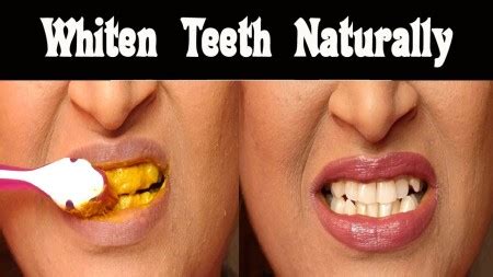 Turmeric Teeth Whitening Does Turmeric Whiten Teeth Hoax How to Use Results Before and After