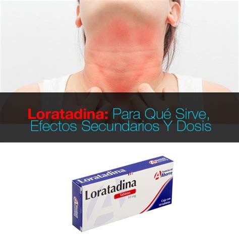 Loratadina: para qué sirve, efectos secundarios y dosis - La Guía de ...