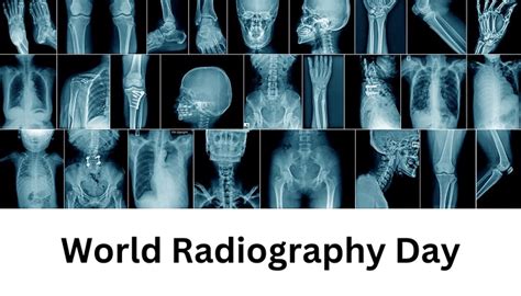 World Radiography Day: History & significance