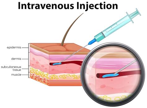 Intravenous injection on white background Vector | Premium Download