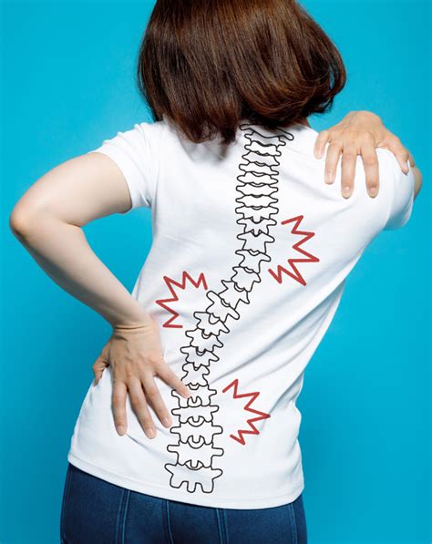 Scoliosis Pain | Scoliosis Symptoms | Pain Relief for Scoliosis