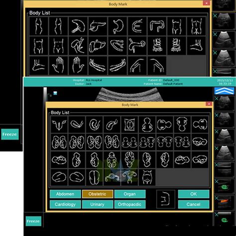 Colour doppler ultrasound in pregnancy : abdominal ultrasound MSLCU36