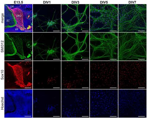 Frontiers | Retracing Schwann Cell Developmental Transitions in Embryonic Dissociated DRG ...