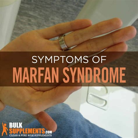 Marfan Syndrome: Understanding Causes, Symptoms, & Treatment