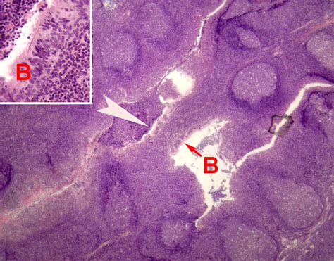 Pharyngeal Tonsils Histology Labeled