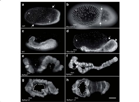 flipflop-and RhoGEF2-RNAi knockdown interferes with early embryonic... | Download Scientific Diagram