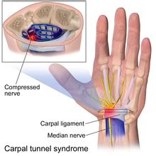 Wrist Extensor Retinaculum Injury