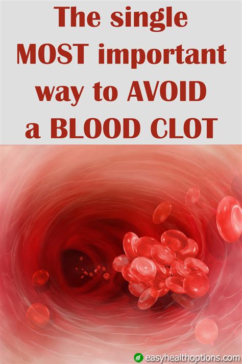 The single most important way to avoid a blood clot - Easy Health Options®