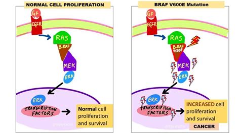 BRAF Gene and "BRAFoma's" - Pathology Made Simple