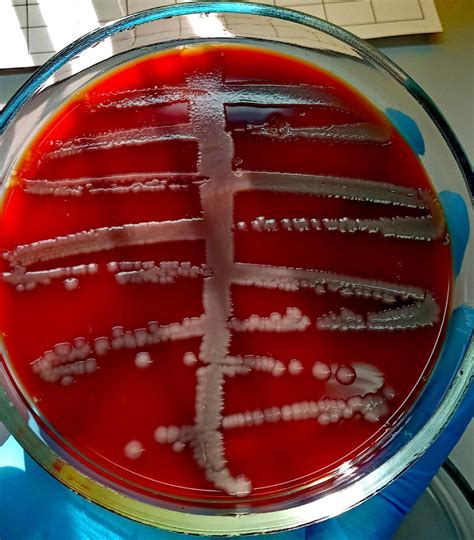 Escherichia coli from urine Ecoli, Microbiology Lab, Ppt, Bacteria, Growth, Quick, Stuff Stuff