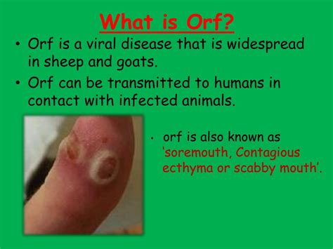 PPT - ORF DISEASE PowerPoint Presentation, free download - ID:2213593