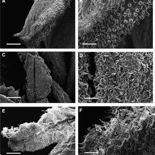 Scanning electron micrographs of the hydathodes (present on the ...