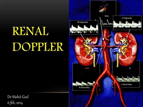 Renal doppler