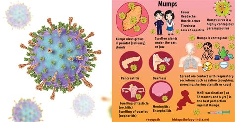 Mumps Virus- An Overview