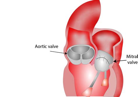 Aortic valve anatomy - Critical Care Sonography