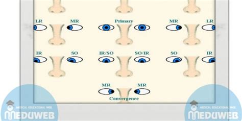 Clinical hints for your approach for examining ocular motility - Meduweb