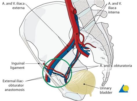 Acetabulum - Approach - Ilioinguinal approach - AO Surgery Reference | Vascular surgery ...