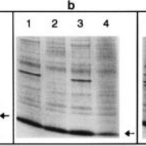 SDS-PAGE analysis of total cell lysate samples from induced recombinant ...