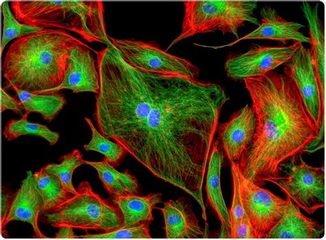 P53 and Cancer-Associated Fibroblasts