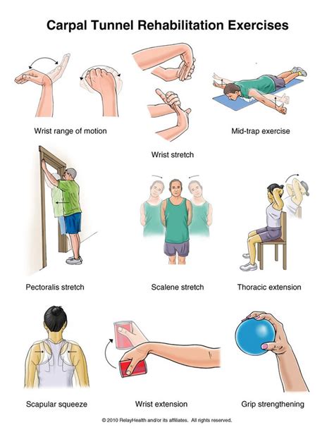 12 best Carpal Tunnel Syndrome images on Pinterest | Carpal tunnel syndrome, Remedies and Hand ...