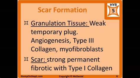 Complement System, Granulomas, Exudate Granulation Tissue C5a multinucleated giant cells - YouTube