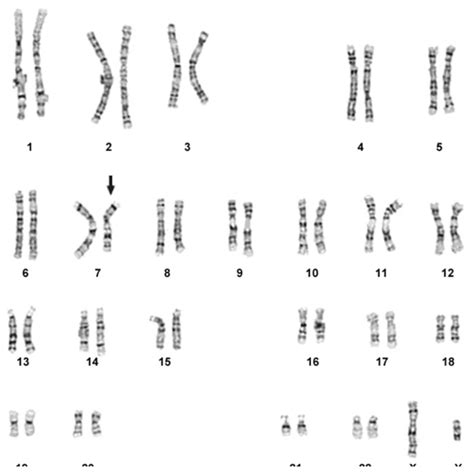 Karyotyping and FISH with MetaClass image analysis system - MICROPTIC